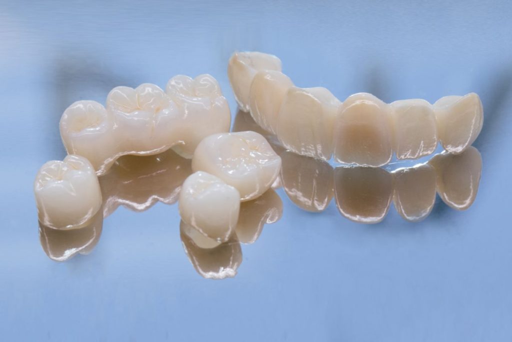 What to Expect from Dental Implants