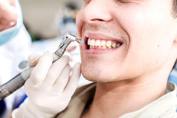 Should I See A General Dentist Every Six Months?