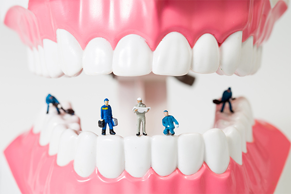 Popular General Dentistry Tooth Repair Procedures