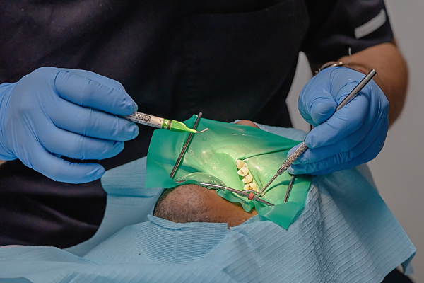 The Real Cost Of Delaying Tooth Replacement